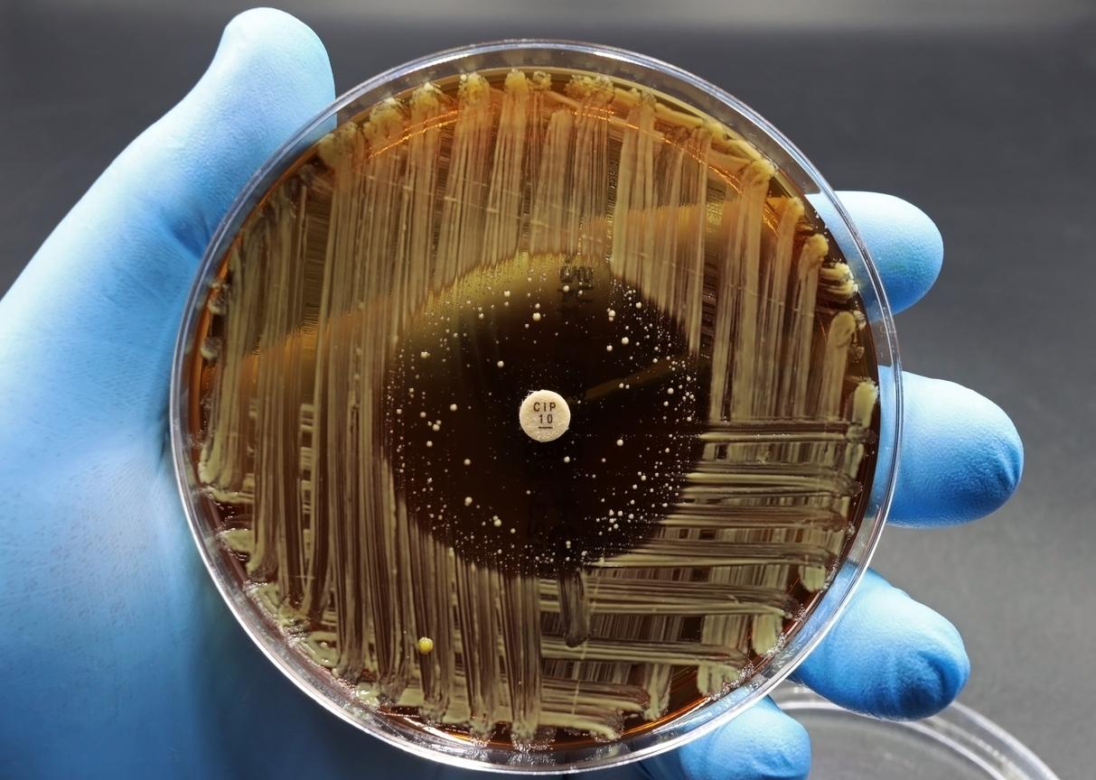Antibiotic-resistant bacteria in petri dish