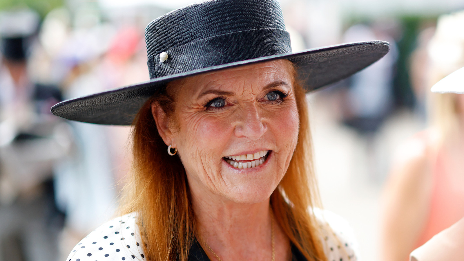 Photos Of Sarah Ferguson Before & After Plastic Surgery