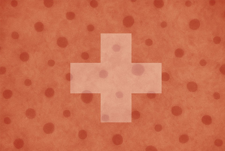 Measles exposure risk reported at Regina airport, flight | 620 CKRM - The Voice of Saskatchewan