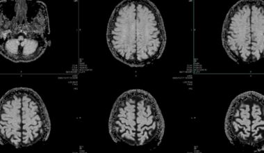 A magnetic MRI scan of a brain.