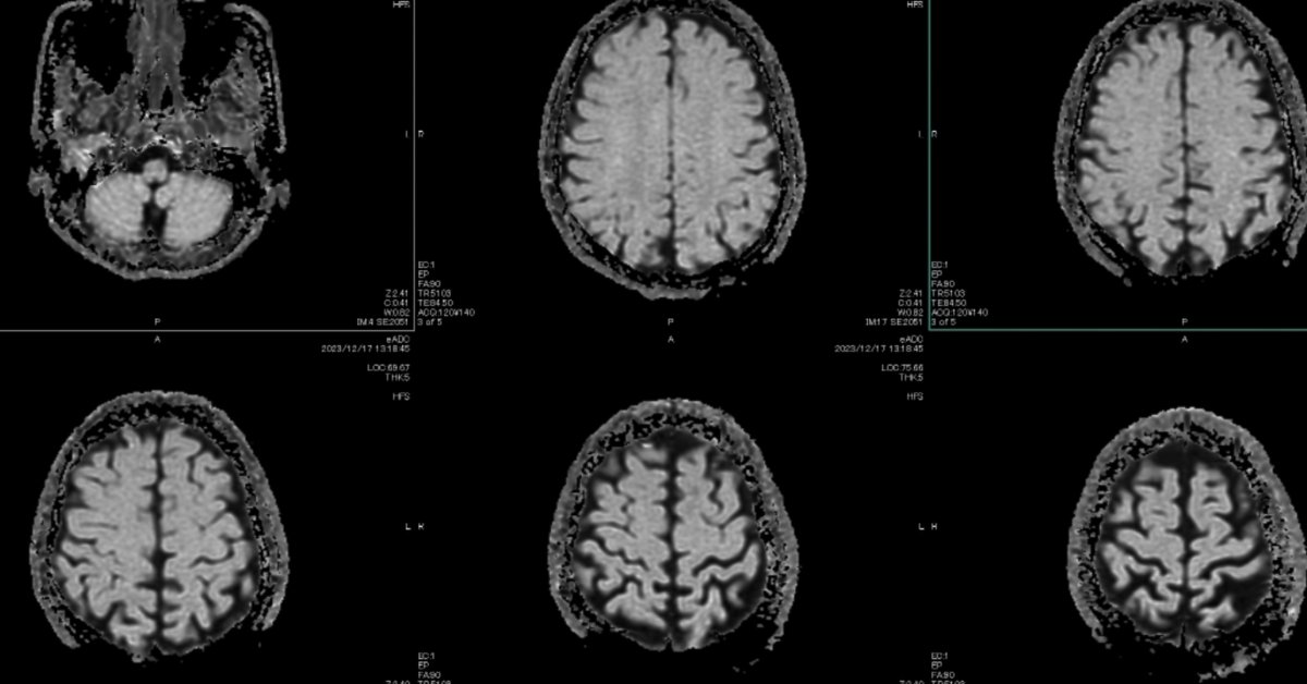 A magnetic MRI scan of a brain.