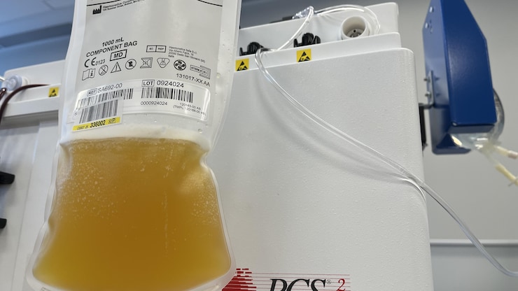 Plasma is a protein-rich liquid that helps treat bleeding disorders, liver diseases and cancer. It is collected through a machine that draws blood from a person's arm, separates the plasma, and returns other components to the person.