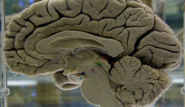 Tips to exercise your brain to lower risk of dementia