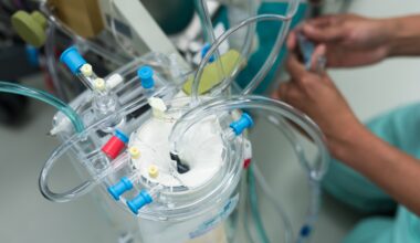 The hands of a perfusionist preparing heart-lung bypass equipment.