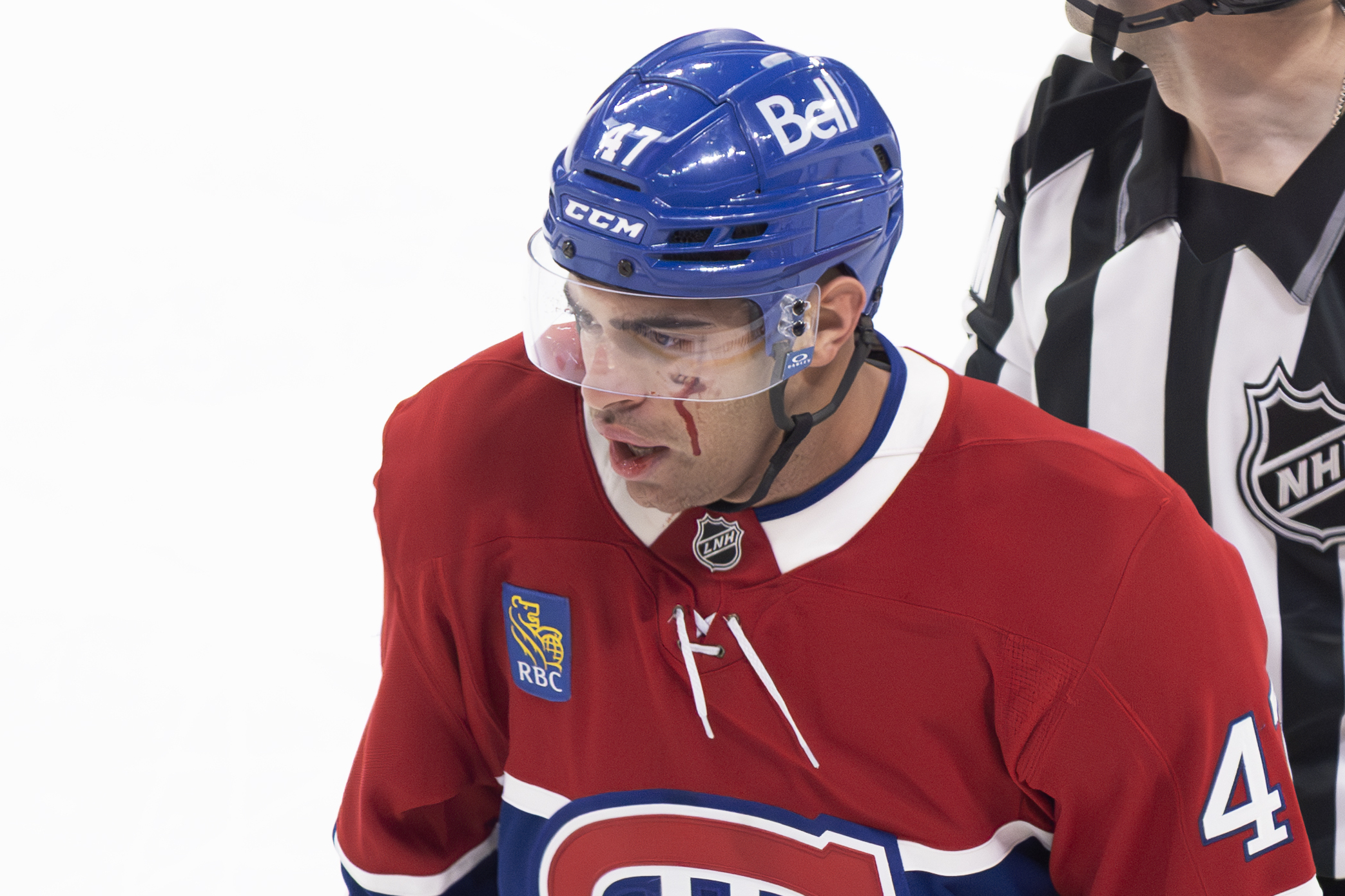 Hockey player heads to the penalty box with blood running down his cheek after getting into a fight