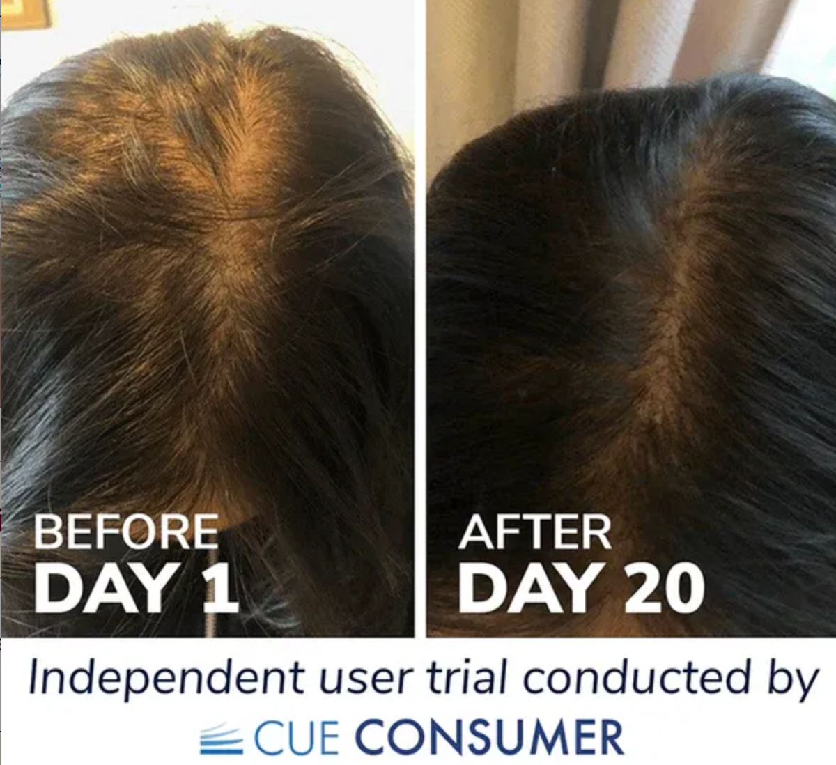 Before and after results using Reverse Life