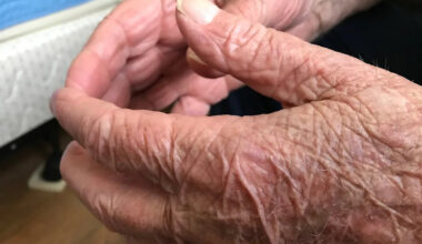 Wait times for Winnipeg home care assessments haven't budged in 5 years: data