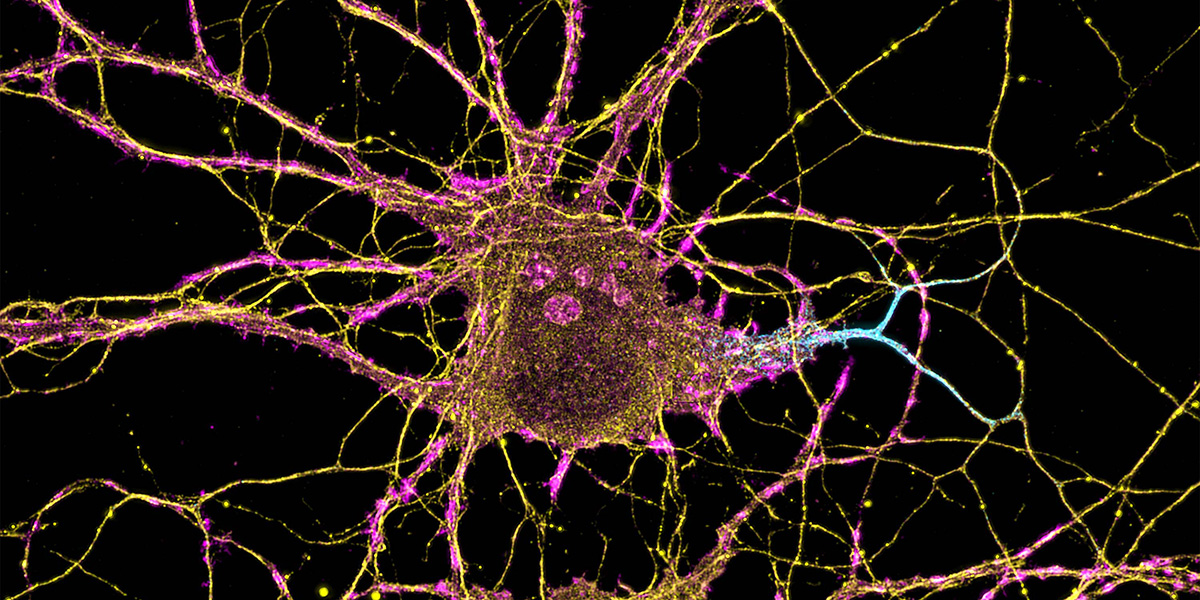 The molecular orchestra of memory