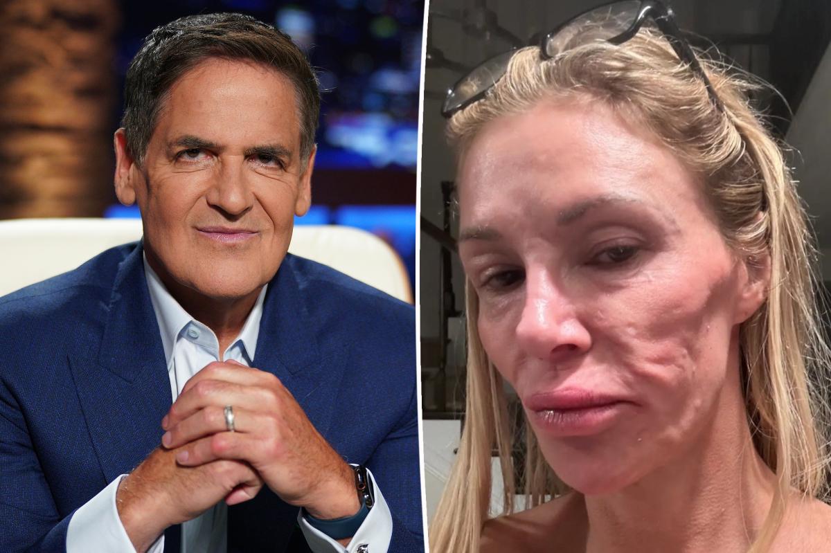 Brandi Glanville turned to Mark Cuban for help with six-figure medical bills from facial disfigurement