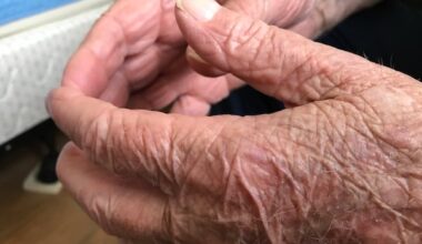 Wait times for Winnipeg home care assessments haven't budged in 5 years: data