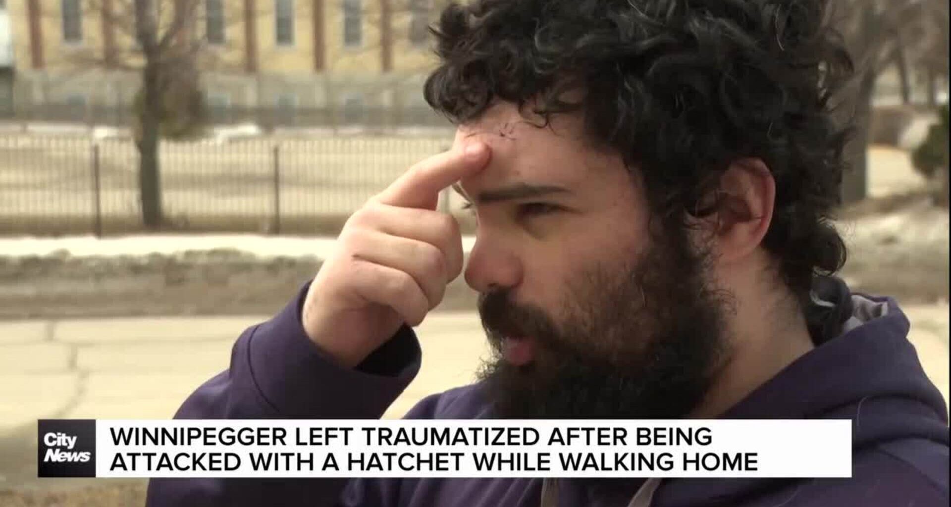 Winnipegger injured, traumatized after being attacked with hatchet in North End
