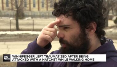 Winnipegger injured, traumatized after being attacked with hatchet in North End