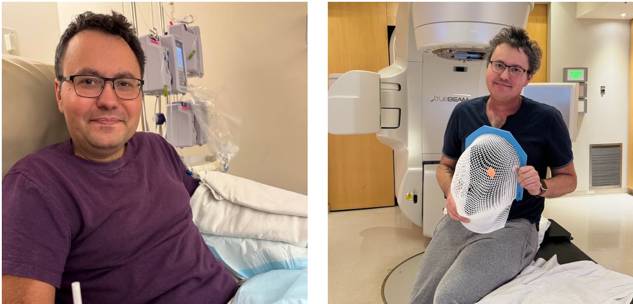 Man having chemotherapy and radiation treatment.