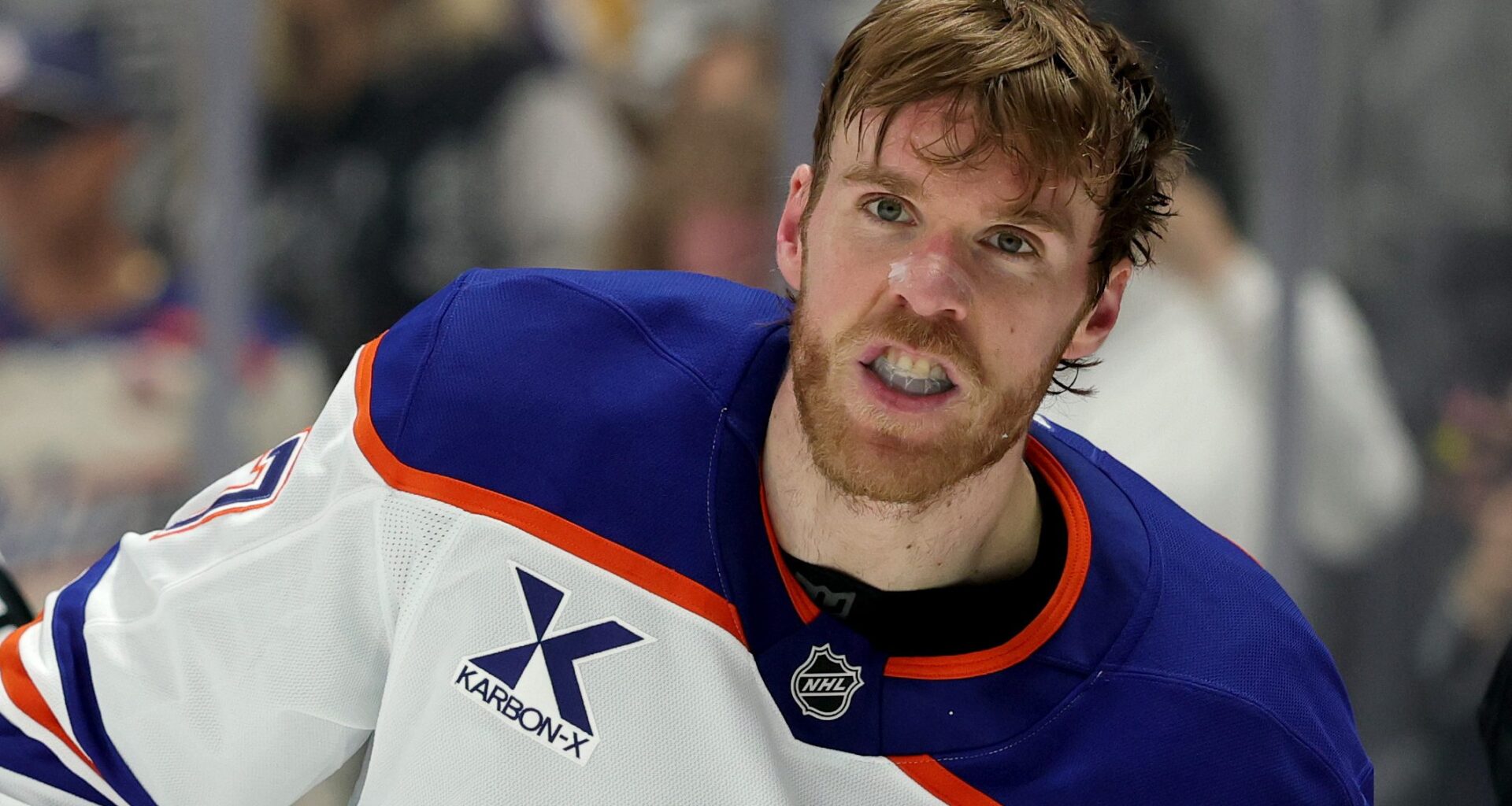 Oilers, McDavid Could Get Good Injury News, Medical Expert