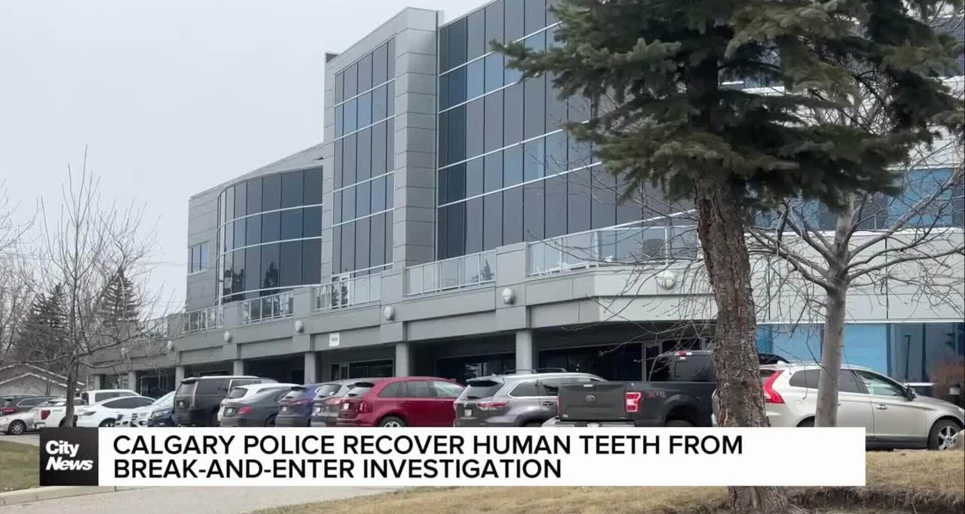 Calgary Police recover human teeth from break-and-enter investigation
