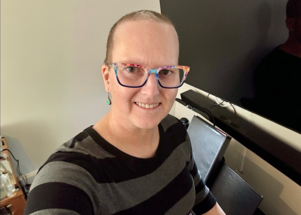 A woman with hair that is growing back in smiles at the camera. She's wearing colourful glasses and a black and grey striped shirt