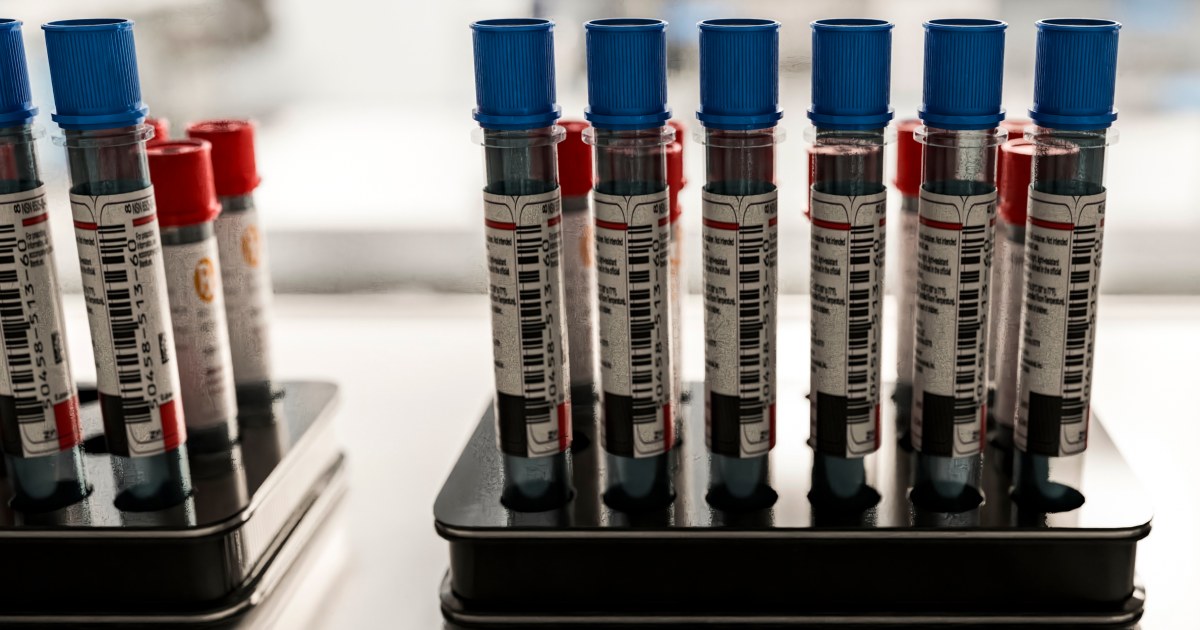 Patients say they want Alzheimer's blood tests. Doctors aren't sure they help.