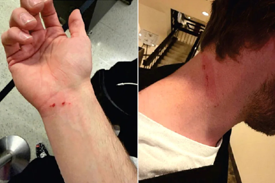 Victim injuriesCredit: U.S. Department of Justice