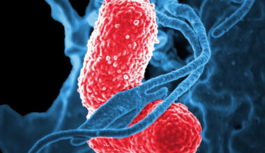 Speedy bacterial infection diagnostics | Interviews