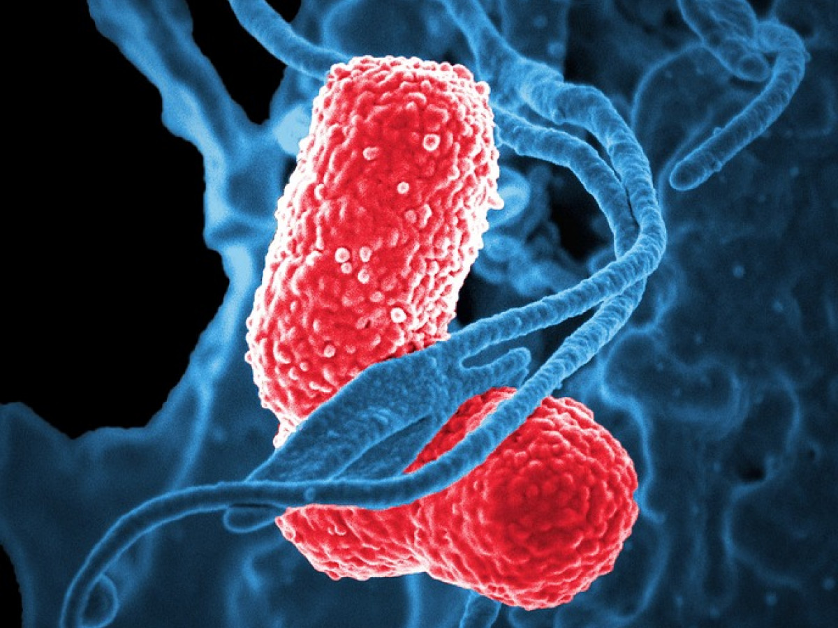 Speedy bacterial infection diagnostics | Interviews