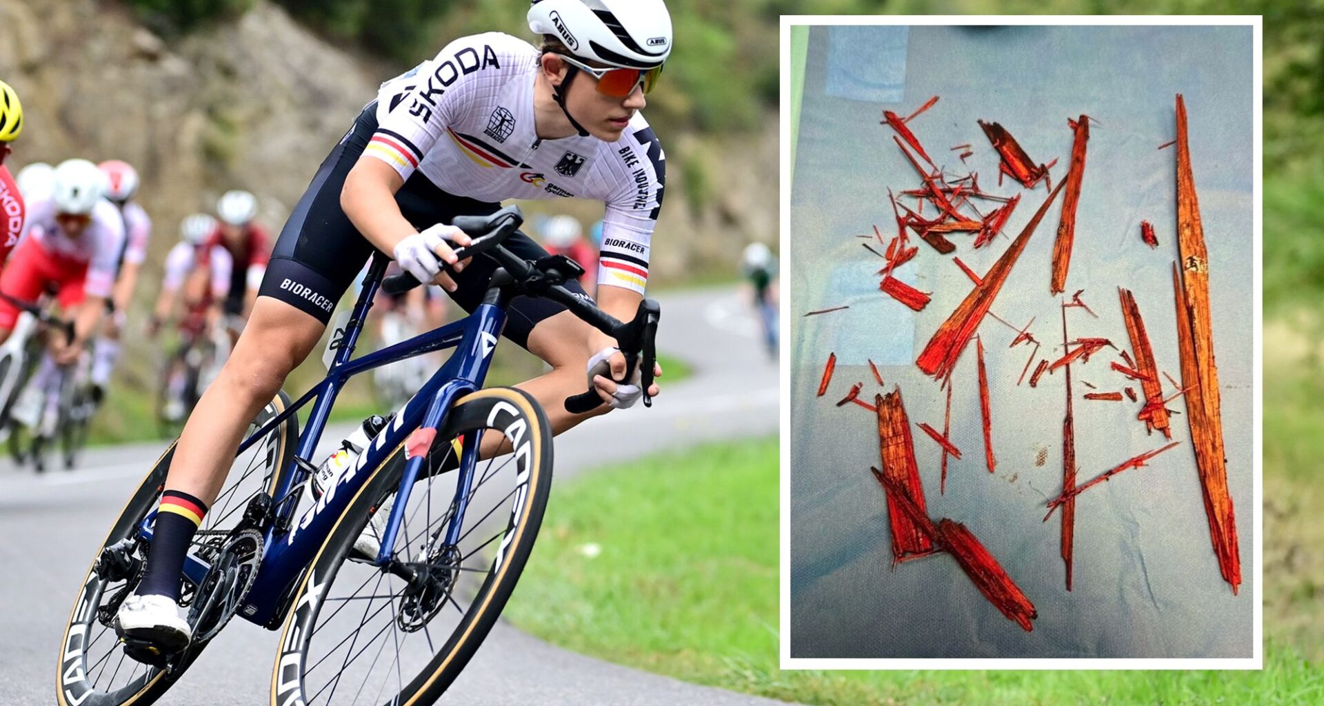 'I got really lucky' – German racer left with 50cm piece of wood lodged in hip after track crash