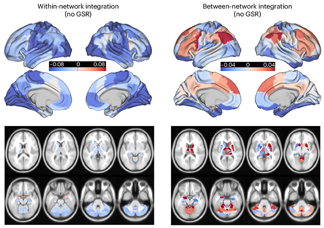 Brain scans