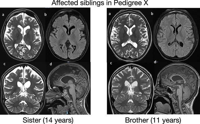 Brain scans