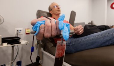 A person reclines in a medical donation chair during a blood or plasma donation, with one hand in the foreground holding a blue glove around tubing connected to a clear collection bag partially filled with dark red blood. Medical equipment and a clinical room setting are visible in the background.