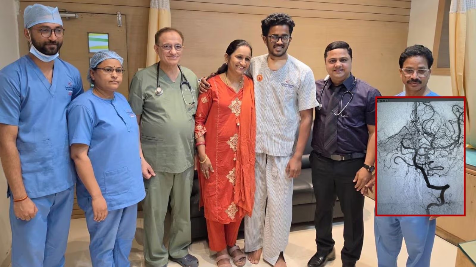 Excessive Gym Workout Triggers Brain Stroke in Nagpur Youth, Timely Treatment Saves Life