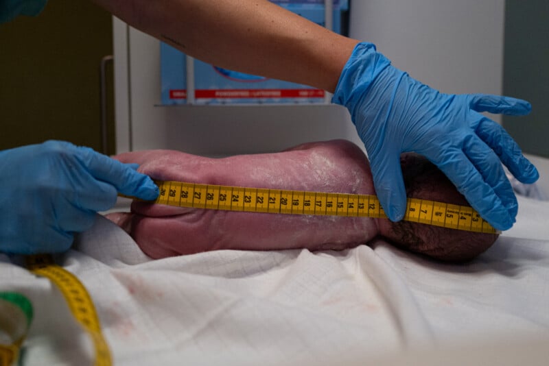 A person wearing blue gloves uses a measuring tape to measure a newborn baby lying on a white cloth in a medical setting.