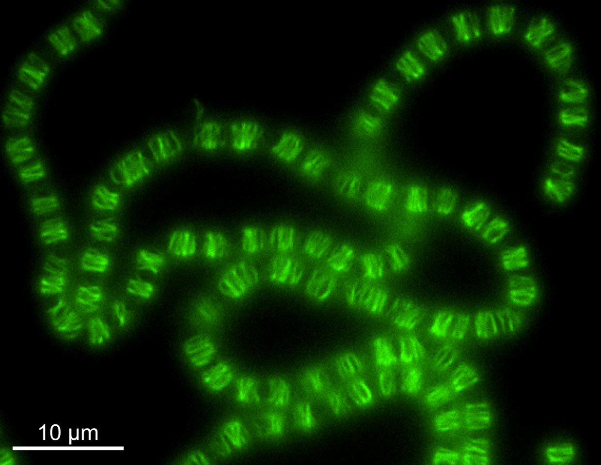 Fluorescent Anabaena