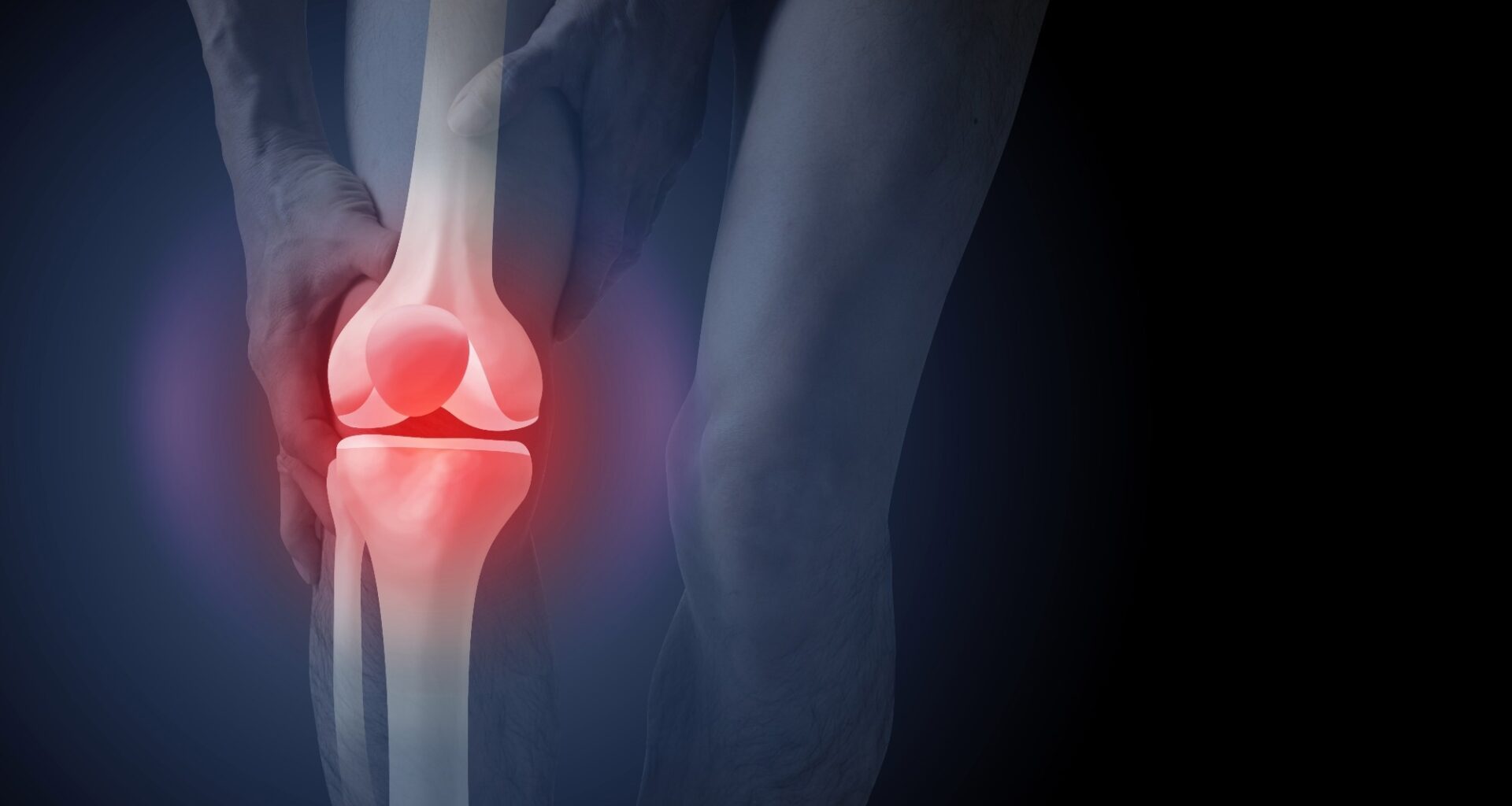 Study: Ultra-processed Foods and Muscle Fat Infiltration at Thigh MRI: Data from the Osteoarthritis Initiative. Image Credit: Atiketta Sangasaeng / Shutterstock
