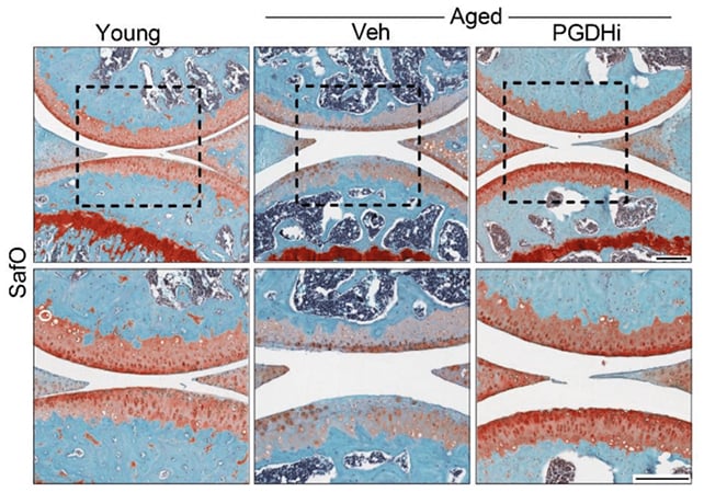 Cartilage scans