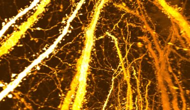 New Synaptic Formation Adolescent Brain