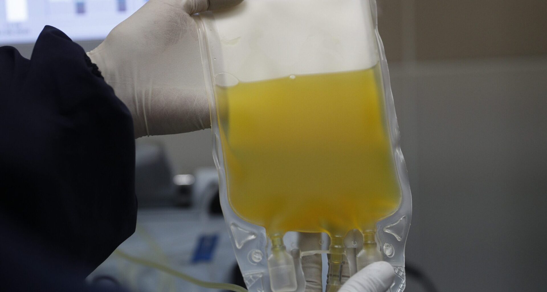 Manitoba medical examiner echoes Health Canada's probe into deaths of plasma donors