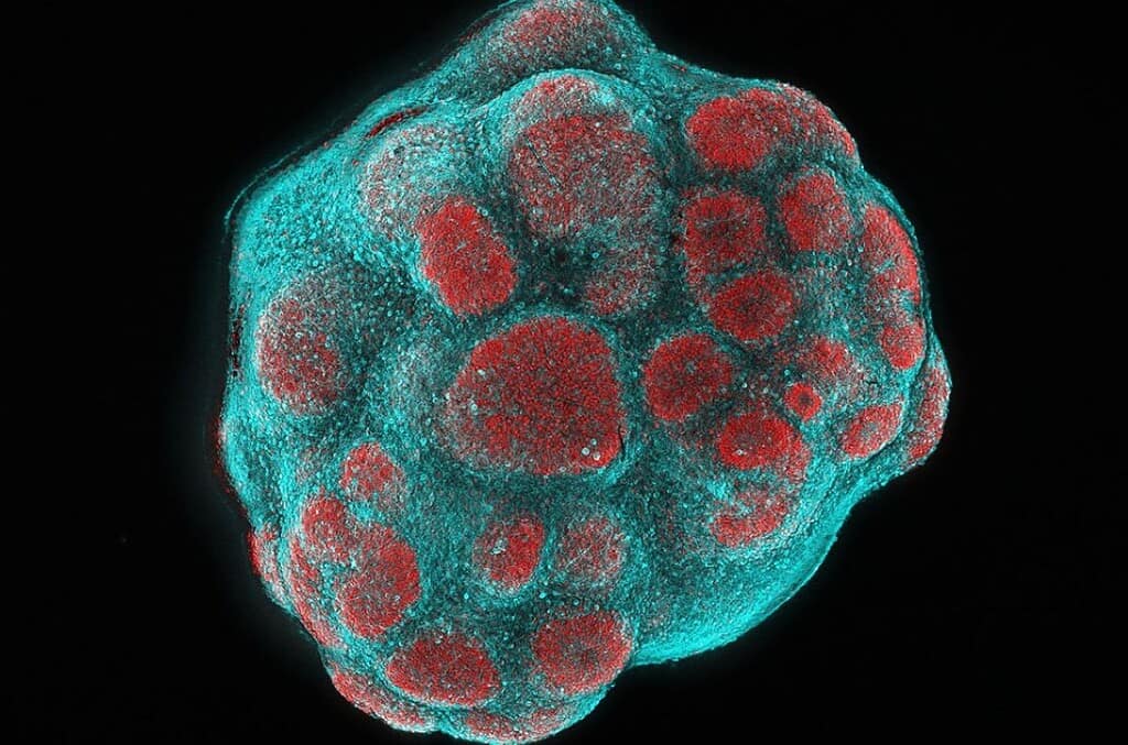 Microscopic view of a cell cluster with red and blue staining, highlighting cellular structures.