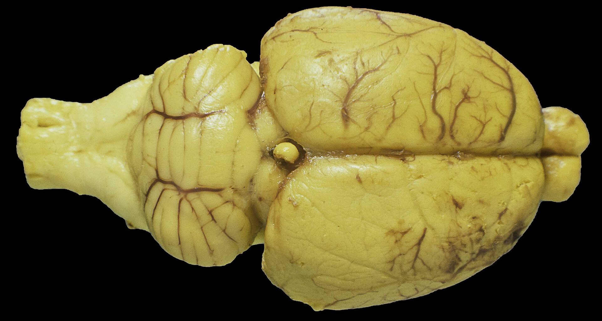 Rat brain