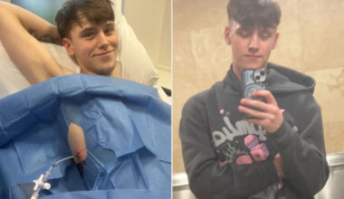 Teen with Collapsed Lung Admits to Vaping in Hospital Before Quitting: 'It's Not Worth It'