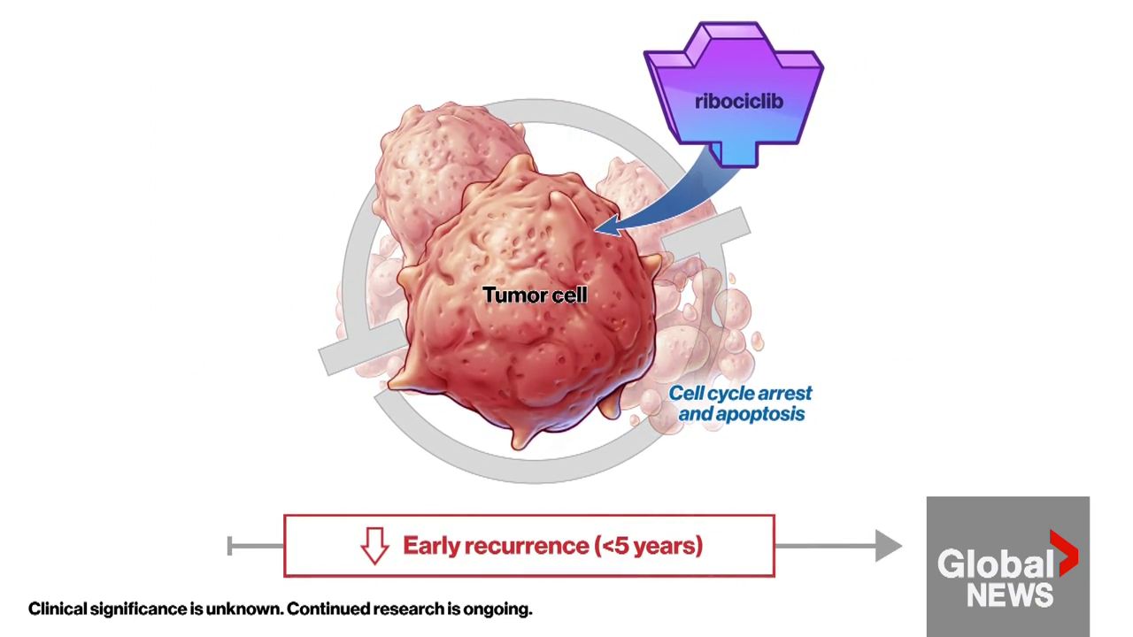 Click to play video: 'New treatment option for breast cancer patients'