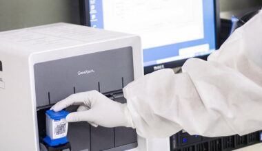 New pooled testing toolkit to help expand TB diagnosis to ‘missed millions’