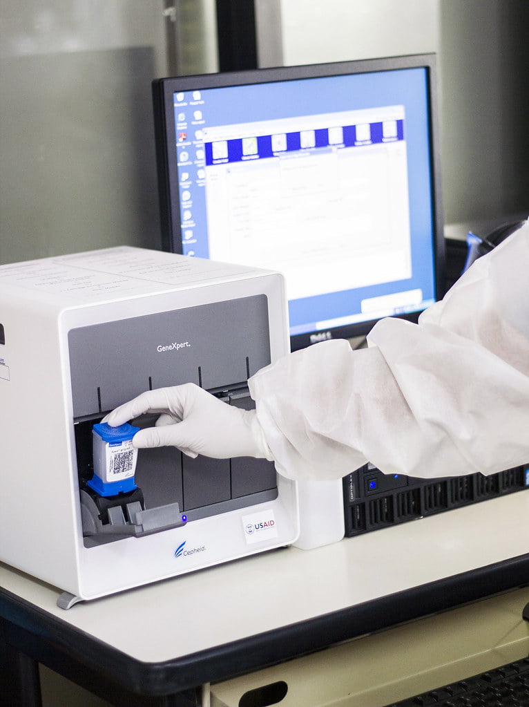 New pooled testing toolkit to help expand TB diagnosis to ‘missed millions’