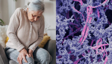 Goodbye, knee pain. In a medical first, scientists have found a way to regrow damaged cartilage.