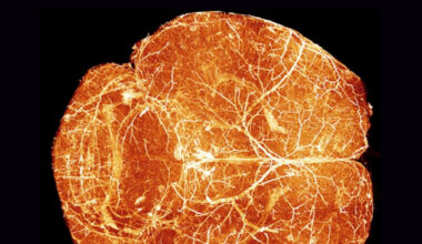 Putting brain development on the map