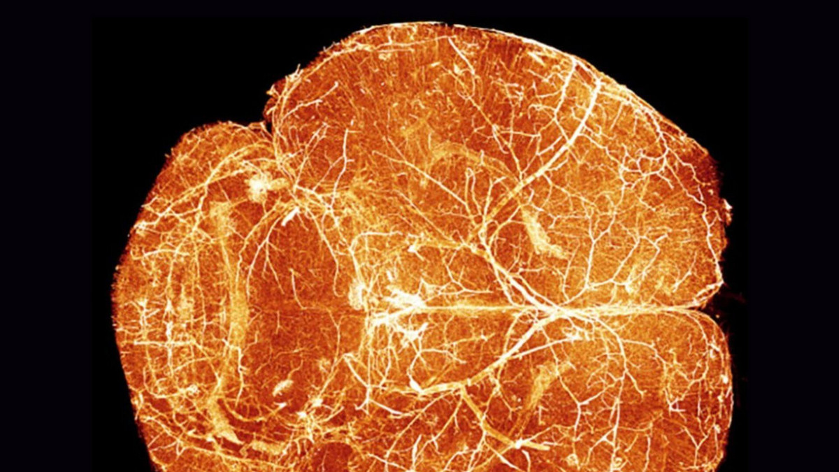 Putting brain development on the map