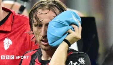 AC Milan and Croatia midfielder Luke Modric holds an ice pack to his left cheek