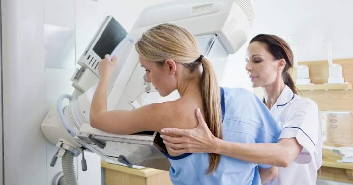 Eligibility age for free breast cancer screening being lowered in Alberta