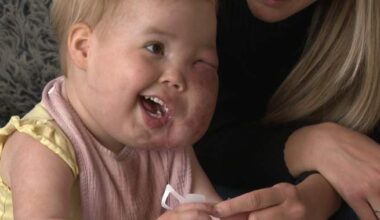 Alberta family faces ‘uncertain future’ after toddler’s rare disease care funding denied