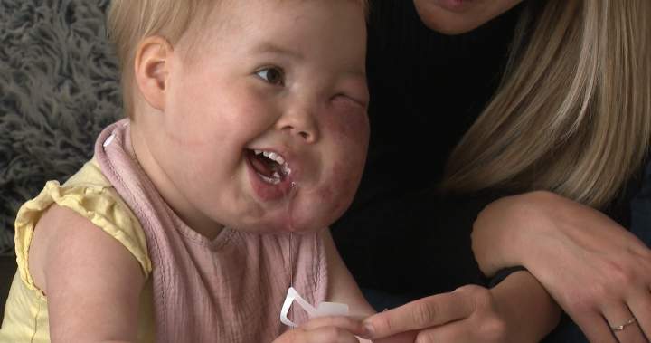 Alberta family faces ‘uncertain future’ after toddler’s rare disease care funding denied