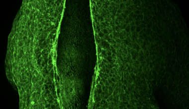 The Physics of Brain Development: How Cells Pull Together to Form the Neural Tube