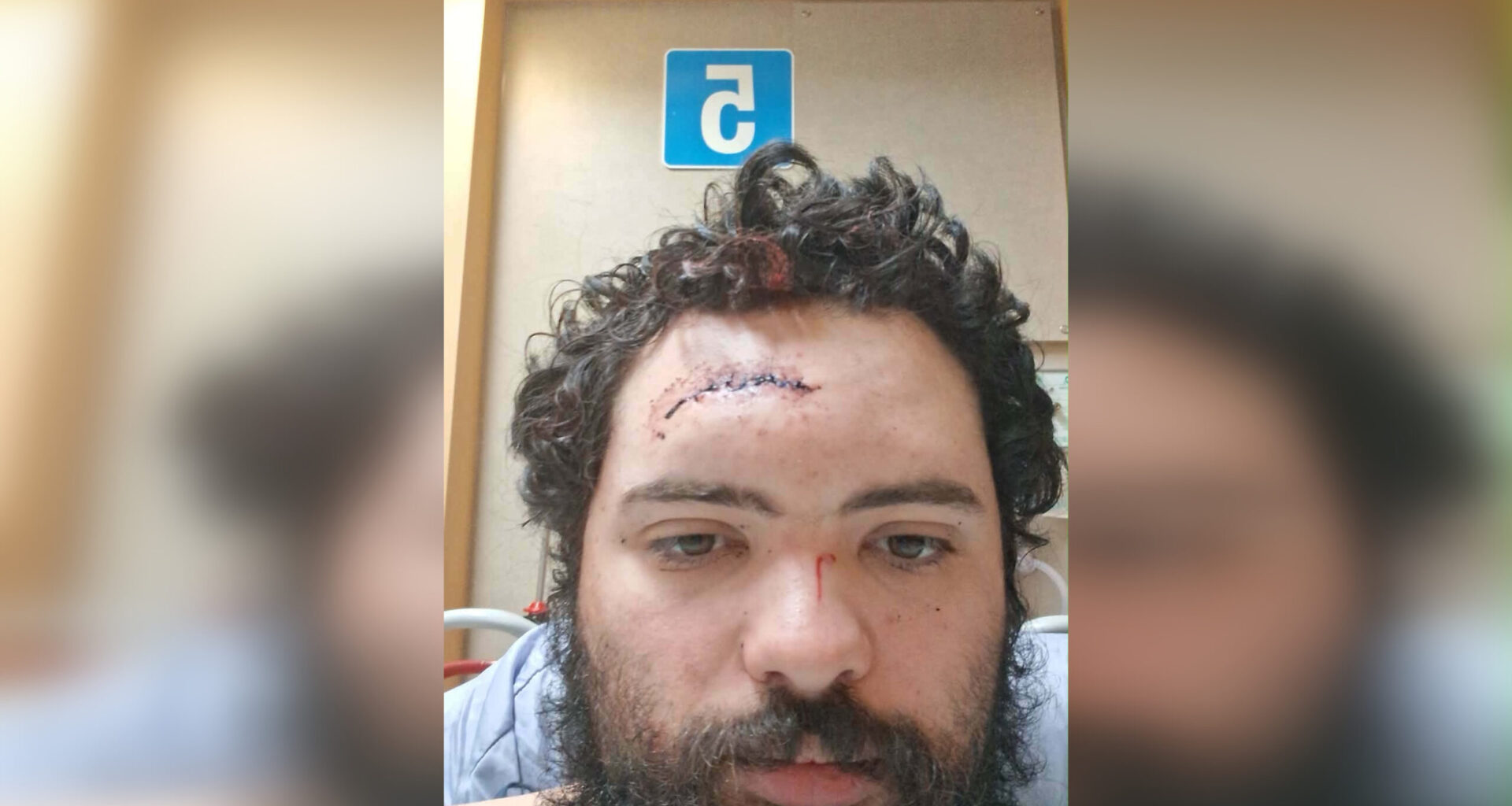 Winnipegger injured, traumatized after being attacked with hatchet in North End